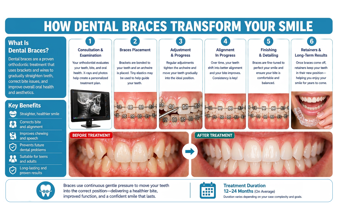dental-braces