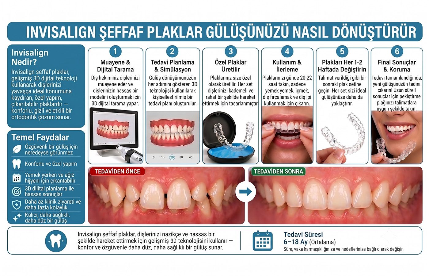 invisalign-seffaf-plak-detay